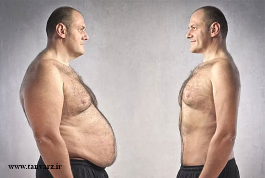 کوچک کردن شکم